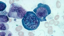 placeholder image to represent content