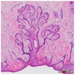 placeholder image to represent content