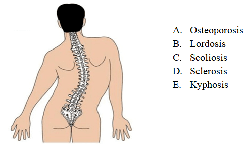 Question Image
