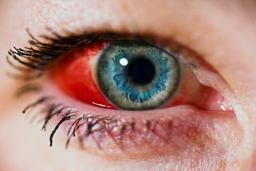 placeholder image to represent content