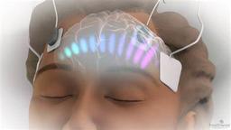 placeholder image to represent content