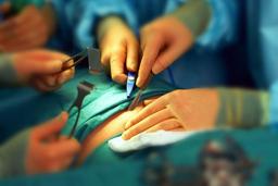 placeholder image to represent content