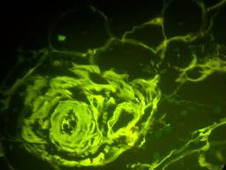 placeholder image to represent content