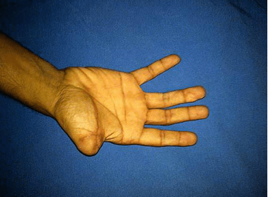 Question Image