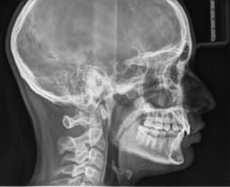 placeholder image to represent content