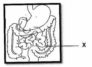 Question Image