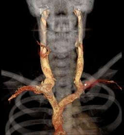 placeholder image to represent content