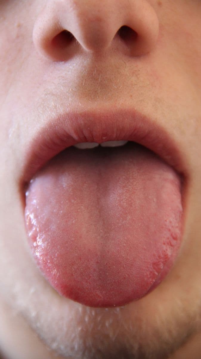 Question Image