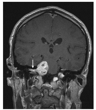 Question Image