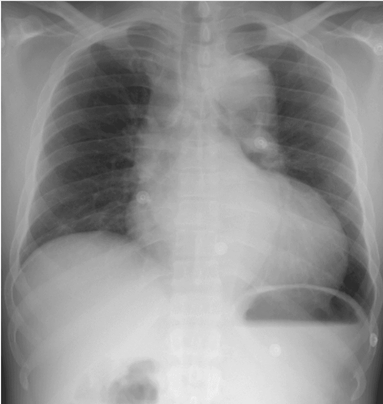 Question Image
