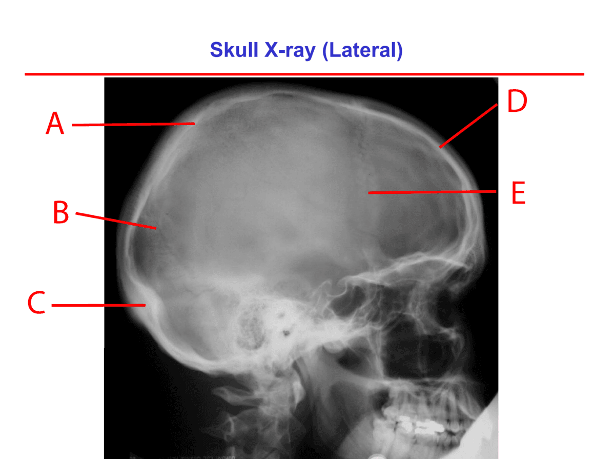 Question Image