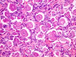 placeholder image to represent content