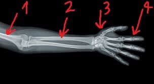 Question Image