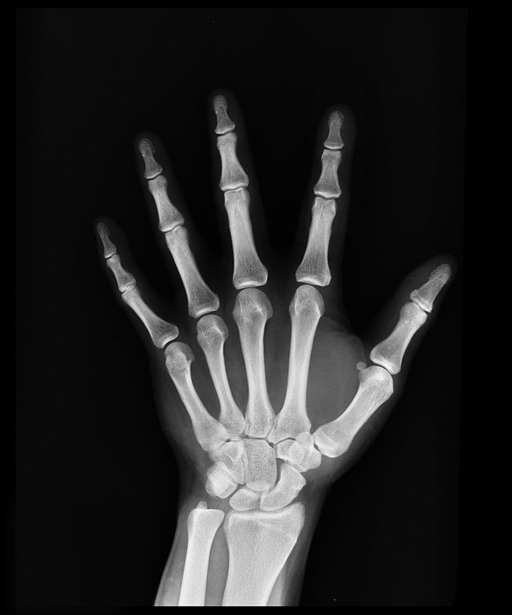 Question Image