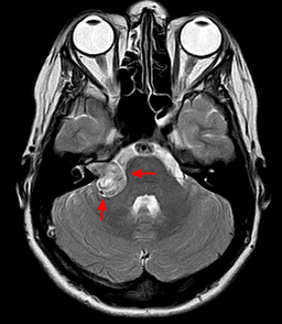 placeholder image to represent content