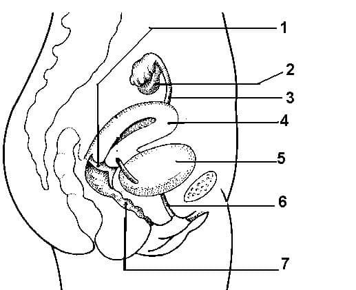 Question Image