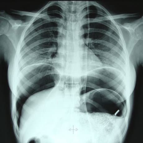 Question Image