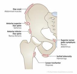 placeholder image to represent content