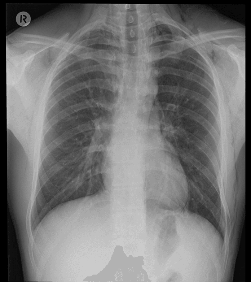 Question Image