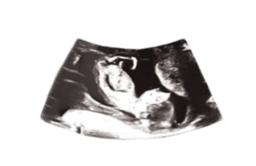placeholder image to represent content