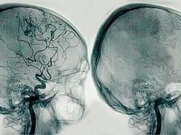 placeholder image to represent content